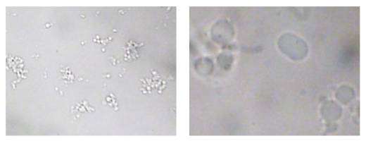 Coacervats observés en microscopie optique