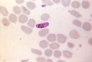 Microgamétocytes de Plasmodium falciparum