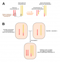 Translocation réciproque et trisomie 21