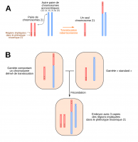 Translocation robertsonienne et trisomie 21