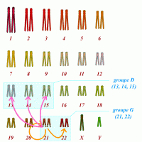 Les translocations robertsoniennes