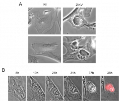 Effet cytopathique du virus Zika sur différents types cellulaires observés au microscope
