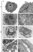 Analyse ultra-structurelle des cellules infectée par le virus Zika par microscopie électronique