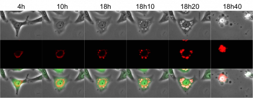 L’infection par le virus Zika induit une vacuolisation provenant du réticulum endoplasmique des cellules infectées