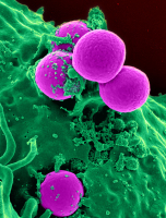 Neutrophile humain phagocytant des staphylocoques dorés résistant à la méticilline