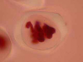 Début d'anaphase de méiose I dans une cellule mère du pollen, premier exemple