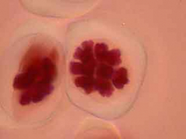 Métaphase de méiose I dans une cellule mère du pollen, deuxième exemple