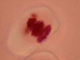 Début d'anaphase de méiose I dans une cellule mère du pollen, deuxième exemple