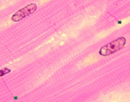 Vue, en microscopie photonique, de cellules musculaires cardiaques de singe