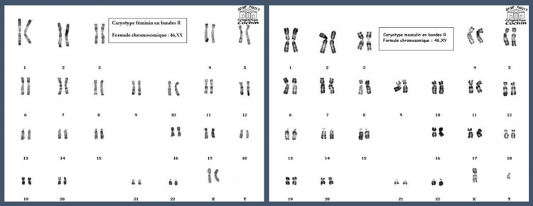 Carytotypes d'une femme et d'un homme
