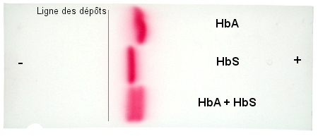 Electrophorèse des hémoglobines A et S