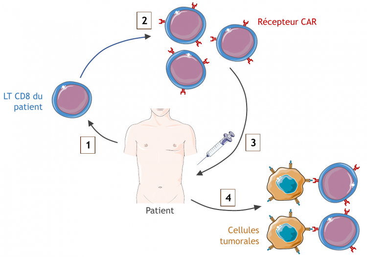 Mode d’emploi des cellules CAR-T