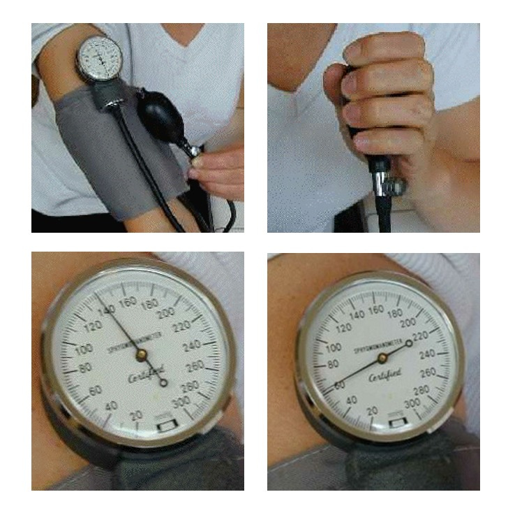 Utilisation du sphygmomanomètre