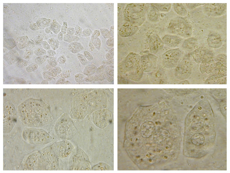 Observation microscopique d'hépatocytes colorés au Lugol