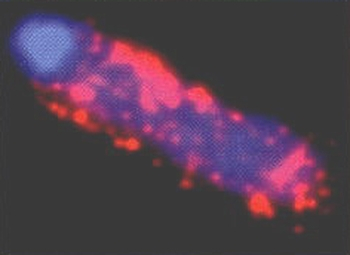 Association de l'ARN Xist au chromosome X inactivé