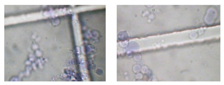 Coacervats observés en microscopie optique après coloration au bleu de méthylène