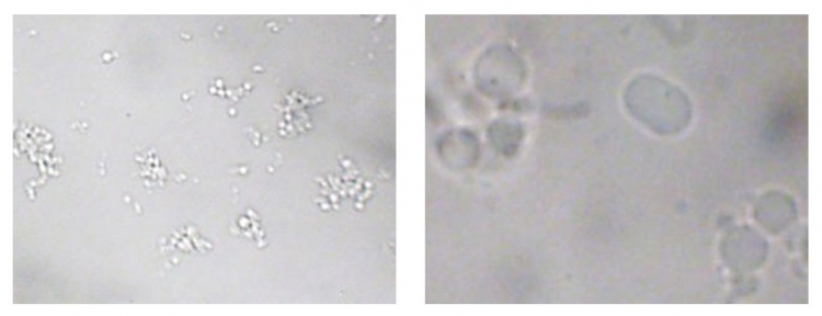 Coacervats observés en microscopie optique