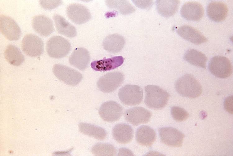 Microgamétocytes de Plasmodium falciparum