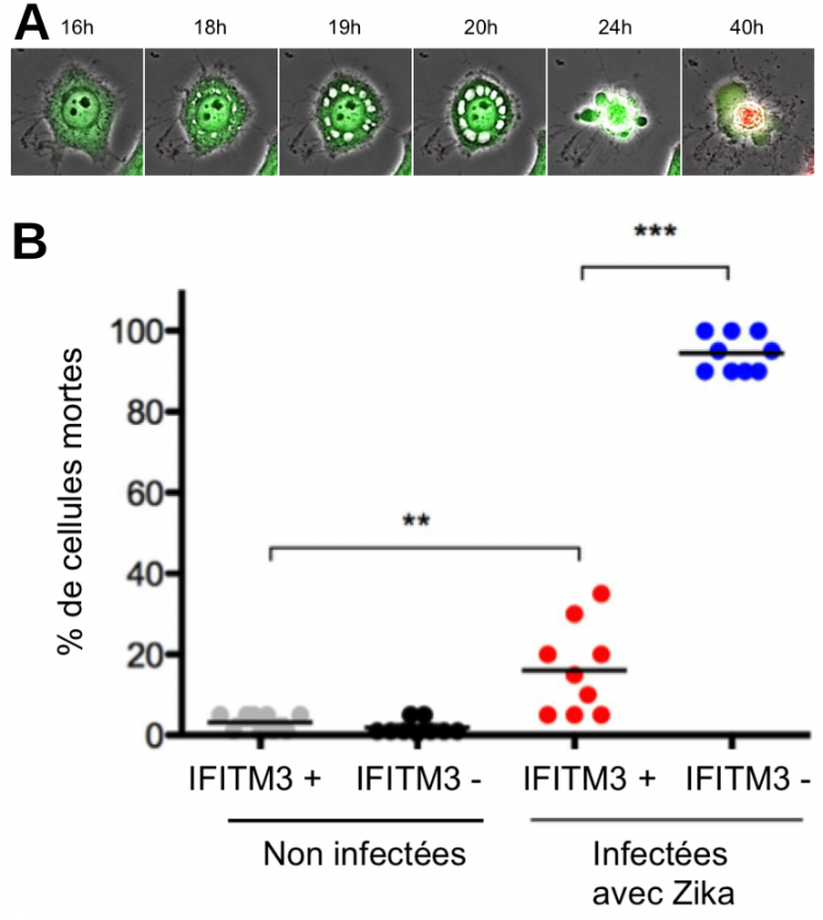Effet cytopathique du virus Zika sur des cellules épithéliales observé en temps réel par vidéo-microscopie