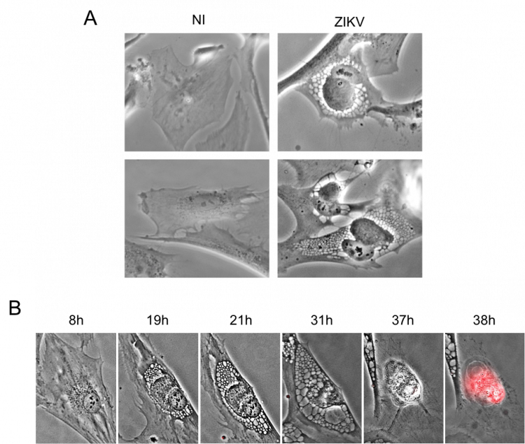 Effet cytopathique du virus Zika sur différents types cellulaires observés au microscope