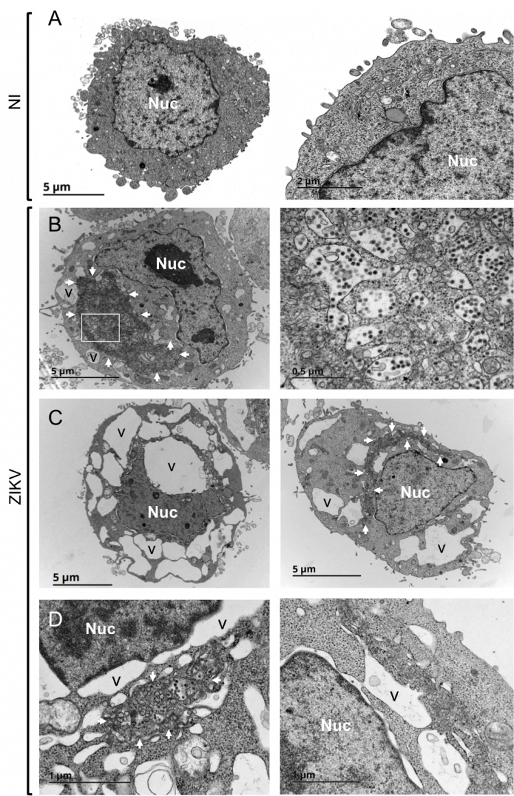 Analyse ultra-structurelle des cellules infectée par le virus Zika par microscopie électronique