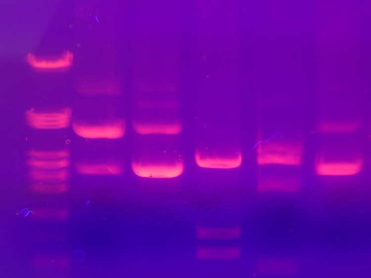 Électrophorèse d'ADN sur gel