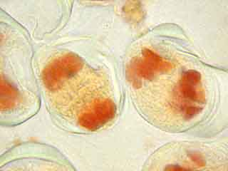 Détail d'une cellule mère du pollen en télophase de méiose I