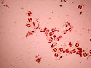 Population de cellules mères du pollen en méiose II