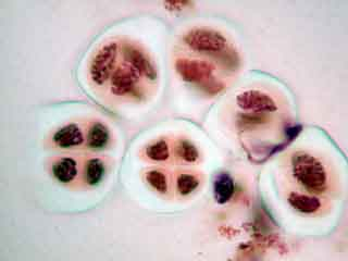 Cellules mères du pollen en méiose II