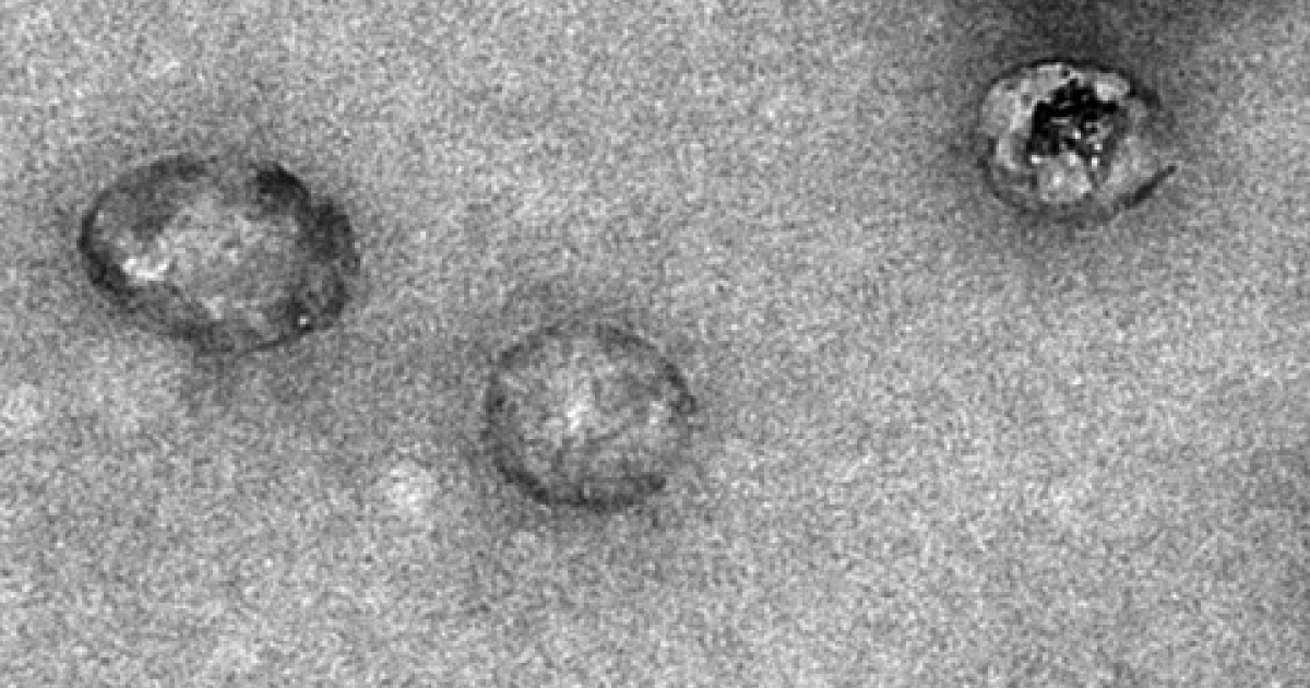 Le virus de l'hépatite C : bilan de 30 années de recherche ...