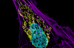 Cellule de cancer de l'os - mitochondries en jaune