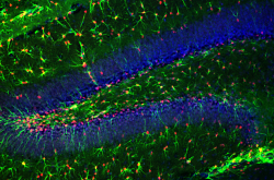 Neurones marqués GFAP et thymidine kinase