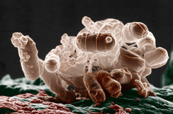 Escherichia coli
