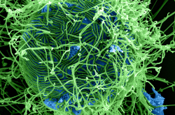 Virions d'Ebola