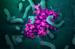 Coronavirus SARS-CoV-2
