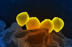 Streptococcus pyogenes