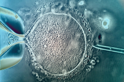 Injection intracytoplasmique de spermatozoïde - ICSI