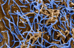 Virions d'Ebola