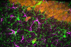 Microglies et neurones
