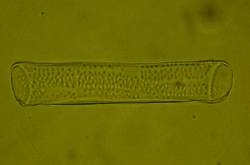 Cellule de vaisseau du xylème