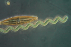 Spiruline et diatomée