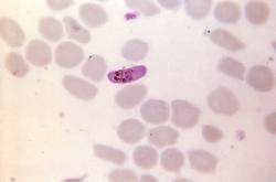 Microgamétocytes de Plasmodium falciparum