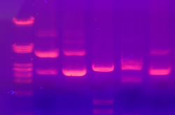 Électrophorèse d'ADN sur gel