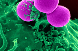 Neutrophile humain phagocytant des staphylocoques dorés résistant à la méticilline