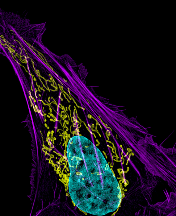 Cellule de cancer de l'os - mitochondries en jaune