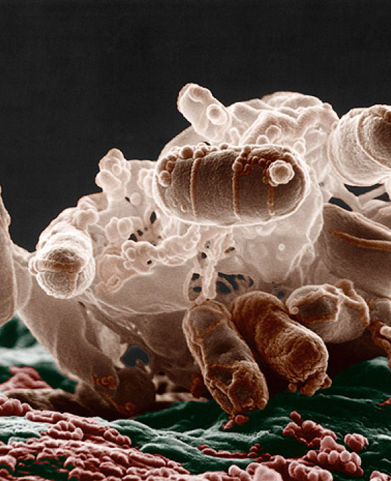 Escherichia coli