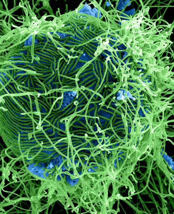 Virions d'Ebola