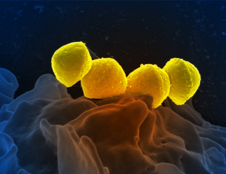 Streptococcus pyogenes