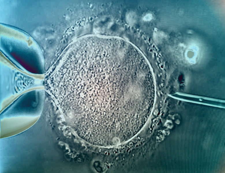 Injection intracytoplasmique de spermatozoïde - ICSI