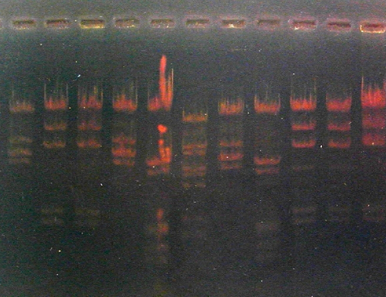 Electrophorèse ADN agarose négatif